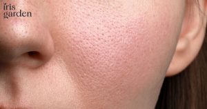 Skin Texture: Causes, Types, and How to Improve It 1 Skin Texture